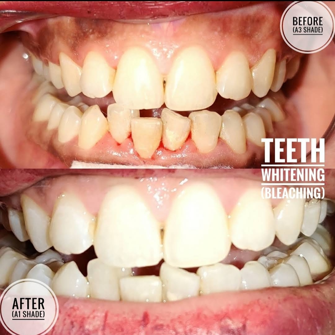 White Roots Dental Clinic